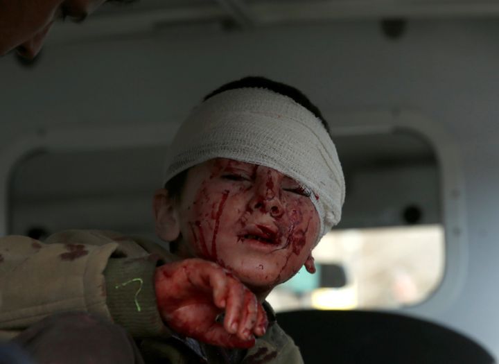 An injured boy sits in an ambulance after the blast