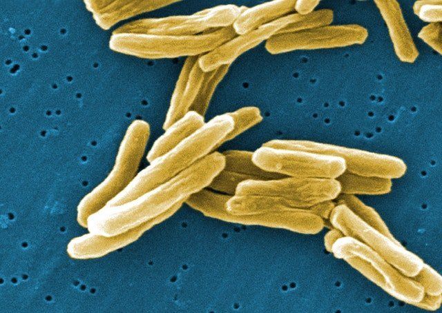 Drug-resistant tuberculosis is a growing threat around the world.