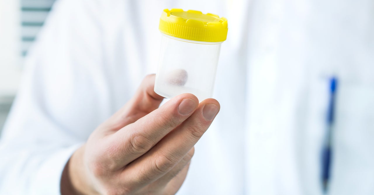 Republicans at the state and federal level have been trying to make drug tests a requirement for welfare, food stamps and unemployment insurance.