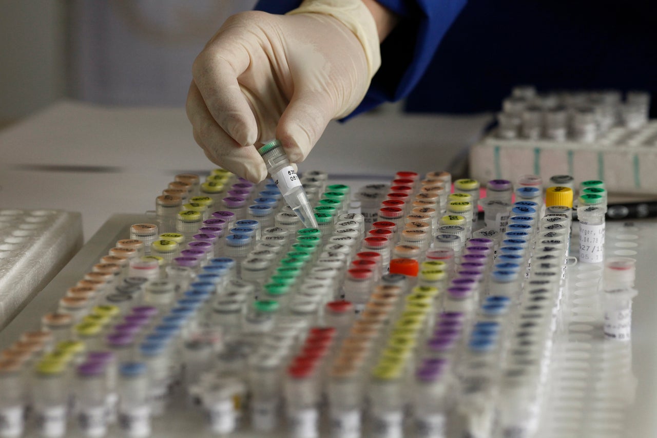 Couples who want to prevent passing genetic conditions onto their children can opt to undergo in vitro fertilization and preimplantation genetic diagnosis. A number of the mother's eggs are harvested, fertilized and allowed to develop for about a week. A few cells are removed from each embryo and tested for genetic or chromosomal abnormalities. A healthy embryo is then implanted in the mother.