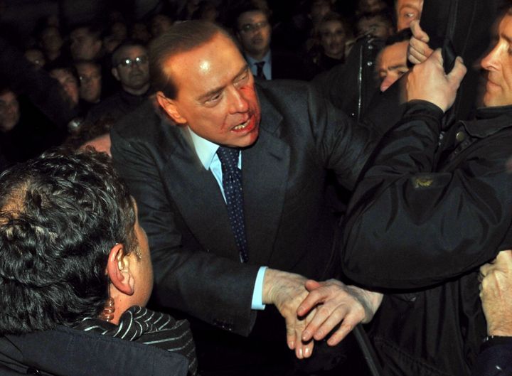 Όταν ο Σίλβιο Μπερλουσκόνι έπεσε θύμα επίθεσης στο Μιλάνο το 2009