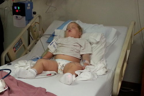 Abbygail Chance, 2, suffered from an irregular heartbeat and sleep apnea, conditions that made her a high-risk patient for a tonsillectomy, according to her mother’s lawsuit. Still, she was referred to Executive Park Surgery Center in Fort Smith, Ark., which discharged her before she woke up fully from her procedure, her mother alleged in the lawsuit. She turned blue on her way home, and her mother took her to an emergency room. She died three days later on Feb. 19, 2015.