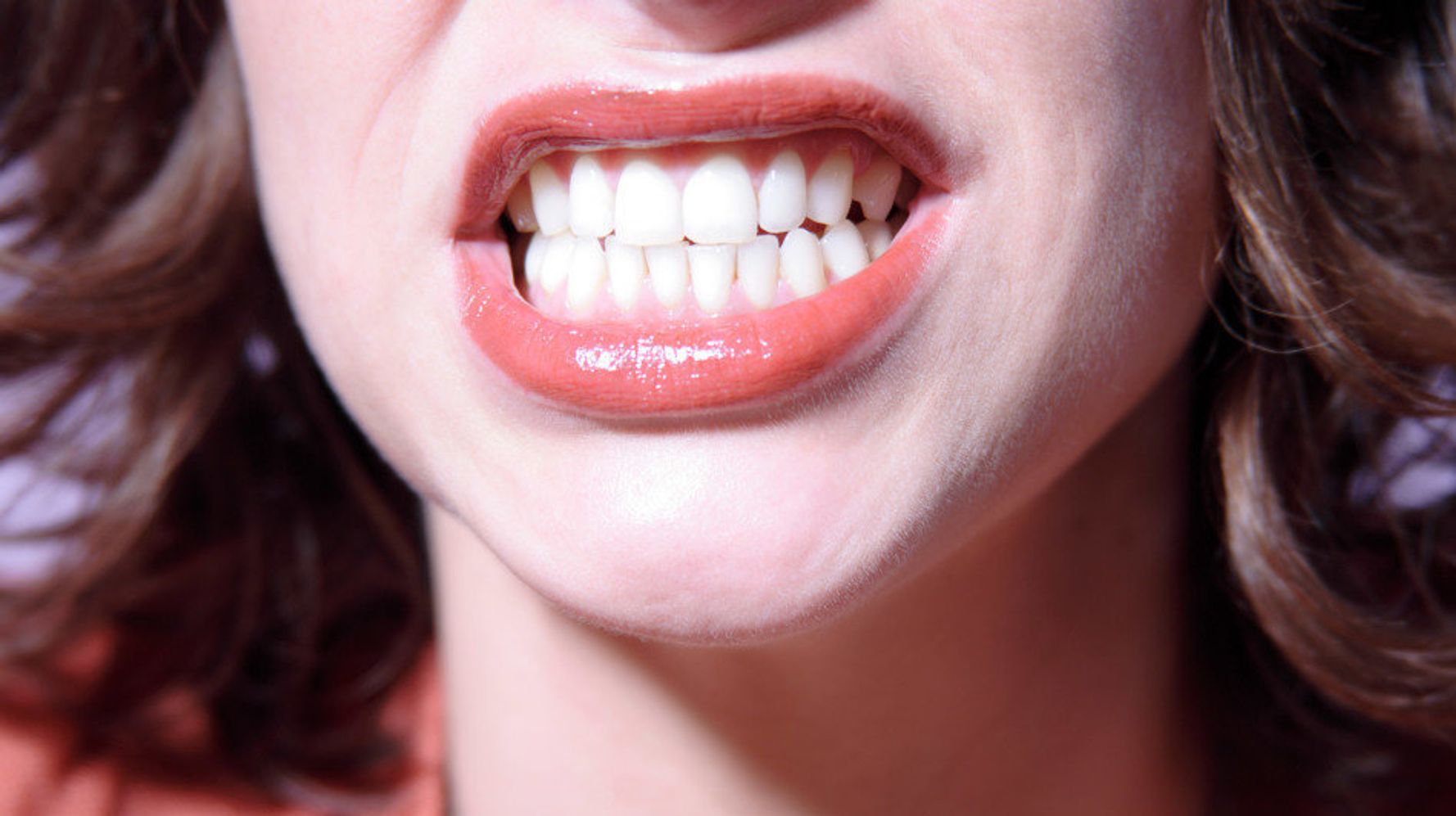 фото нижних зубов