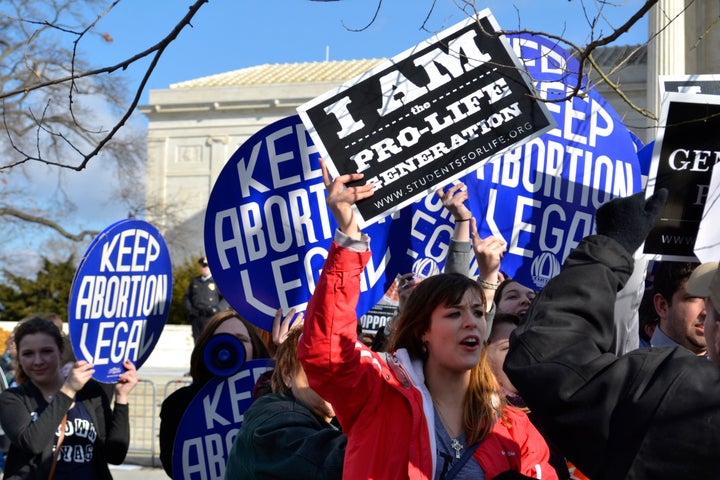 Reproductive rights advocates believe the Ohio law is a bad faith effort to use Down syndrome to further stigmatize abortion.