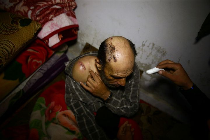 A wounded man in a shelter in Douma, Syria, on March 11, 2018.