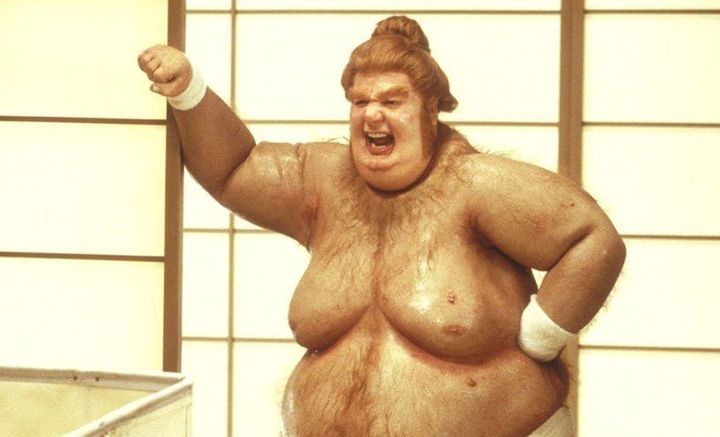 Ο χαρακτήρας «Fat Bastard» από την ταινία «Austin Powers in Goldmember» υπέφερε από γυναικομαστία