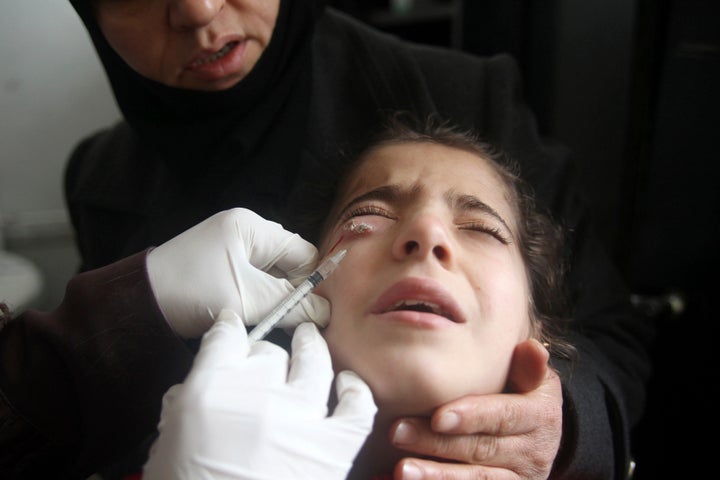 A doctor treats a child showing symptoms of leishmaniasis at a hospital in Aleppo, Syria, on Feb. 11, 2013