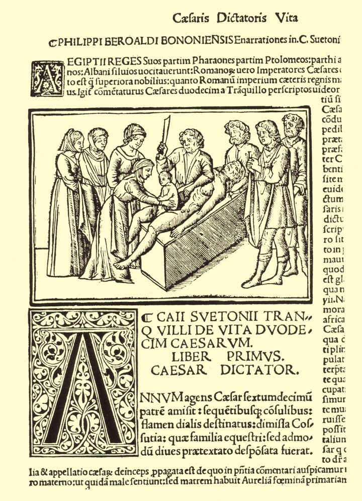 A 16th-century image depicting the legend of Caesar's birth, printed in Filippion Beroaldo's edition of Suetonius' <em>Lives of the Twelve Caesars.</em>