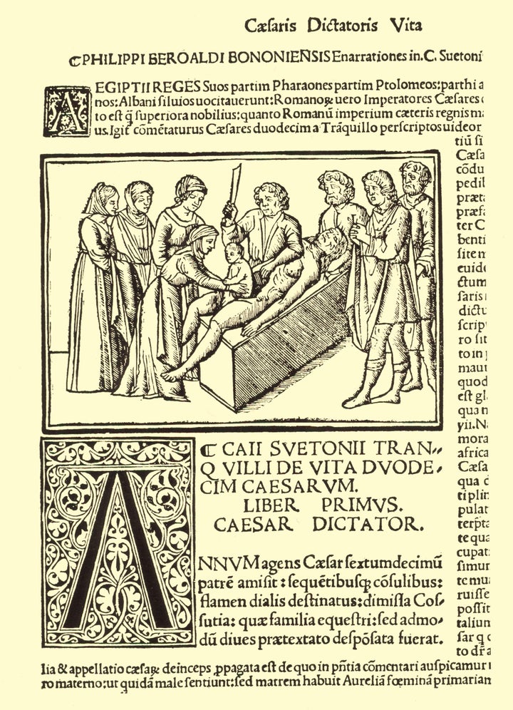 A 16th-century image depicting the legend of Caesar's birth, printed in Filippion Beroaldo's edition of Suetonius' Lives of the Twelve Caesars.