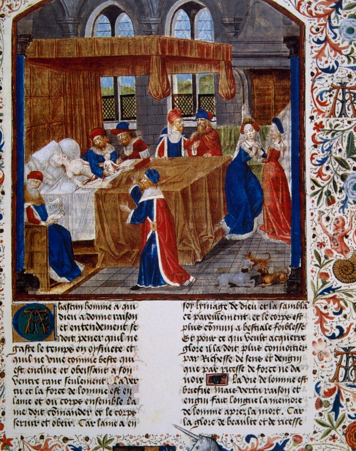 An image of a C-section birth in the medieval work Faits des Romains (Acts of the Romans), which chronicles the life of Julius Caesar.