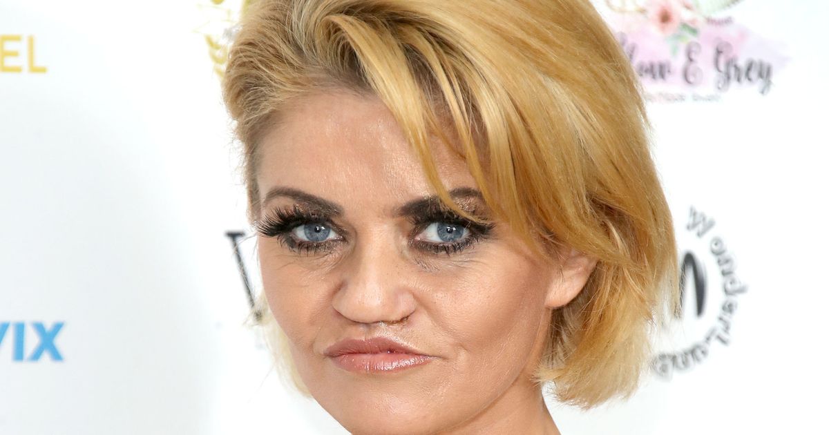 Danniella Westbrook Says Her Face Is ‘rotting Away Due To Botched Surgery Huffpost Uk 4154