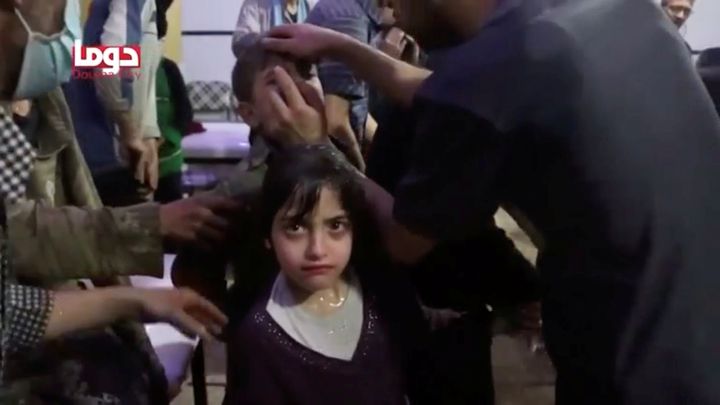 A girl looks on following alleged chemical weapons attack, in what is said to be Douma, Syria.