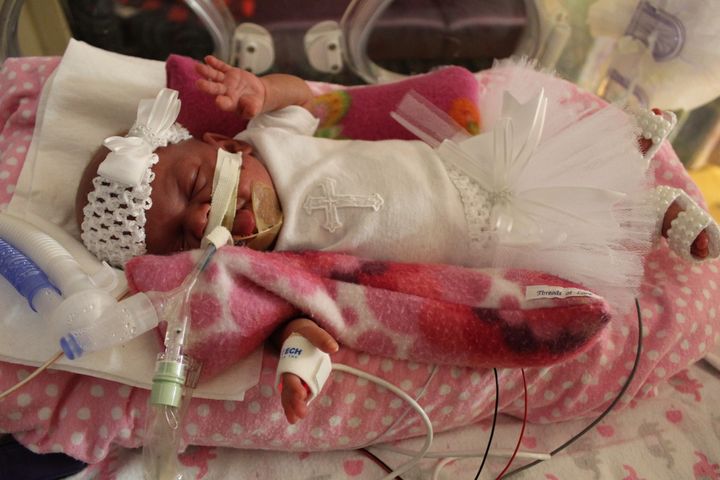 Kaelin Maria was born at just 24.4 weeks.