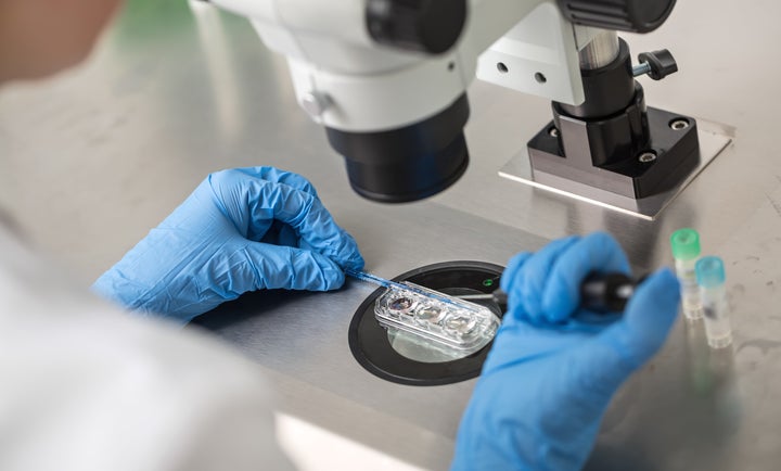 apa itu in vitro fertilization