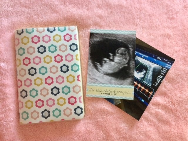 Becky Connolly just chose a regular notepad to document her thoughts and feelings during pregnancy. 