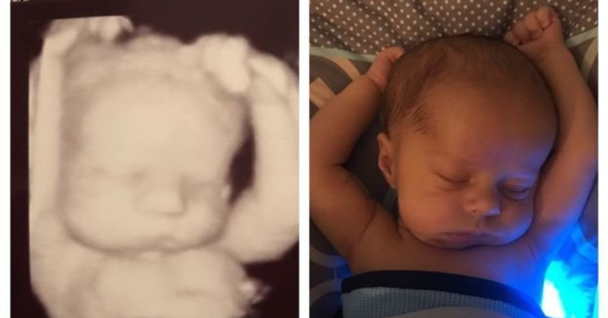 baby-still-sleeps-in-exactly-the-same-position-he-did-in-the-womb