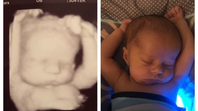 baby scan