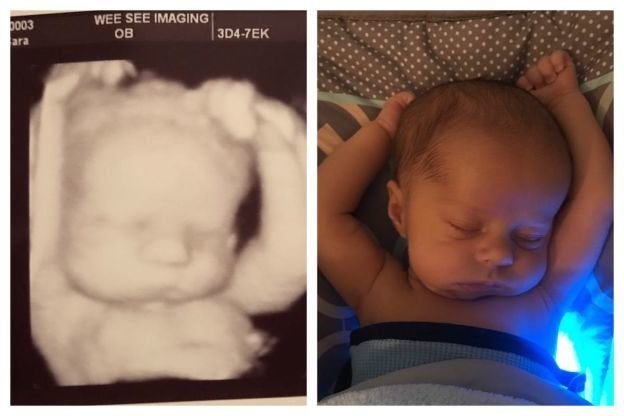 Baby Still Sleeps In Exactly The Same Position He Did In The Womb Huffpost Uk Parents