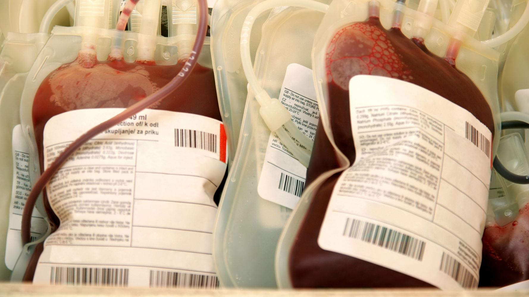 Having Blood Type O Doubles Risk Of Dying From Serious Injury, Research ...