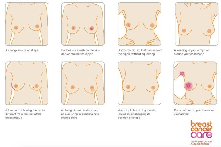 Lump on breast: Types, diagnosis, and other symptoms