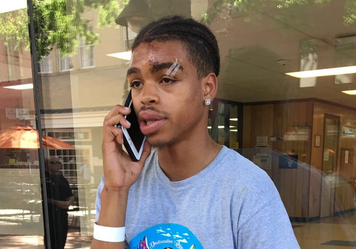DeAndre Harris, a former special education instructor, is shown after receiving treatment for injuries he suffered in a beating as he protested last summer's white supremacist rally in Charlottesville, Virginia.