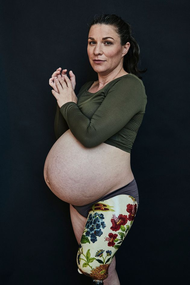 Woman With Prosthetic Leg Couldnt Find Any Maternity Photos Featuring