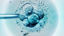 The Stages Of Embryo Transfer: When IVF Gets Weird