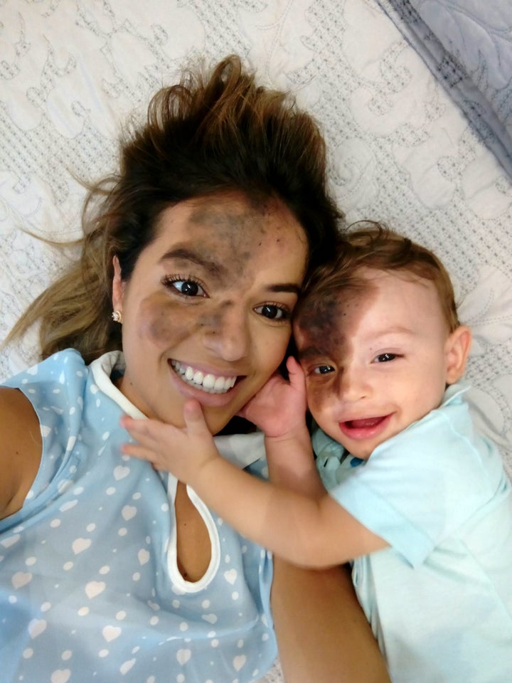Carolina Giraldelli first realised something was different about her son when she saw “frightened” looks on the medics’ faces after she gave birth.