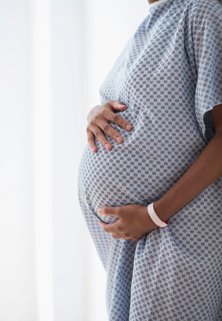 A study of national hospital data found that the rate of severe childbirth complications was significantly higher f