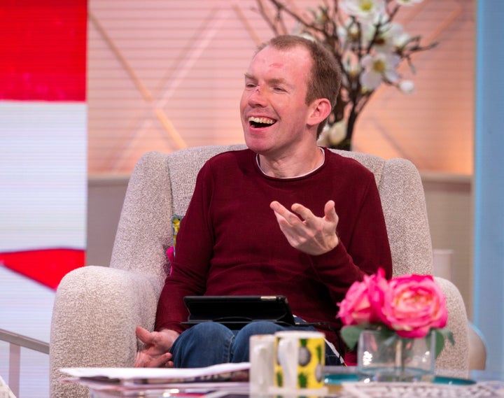 <strong>The comedian speaks on 'Lorraine'</strong>
