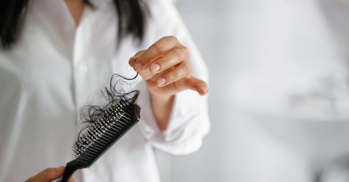 Stress-induced shedding doesn’t always lead to permanent hair loss or baldness, but see a doctor if you notice more strands than usual falling out.