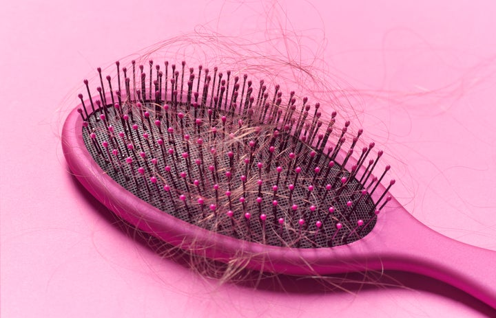 The average person loses 50 to 100 hairs a day. Physical and emotional stress can push hair follicles into a resting period, causing more hair to shed.