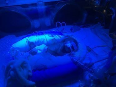 Baby Sofia in the NICU. 