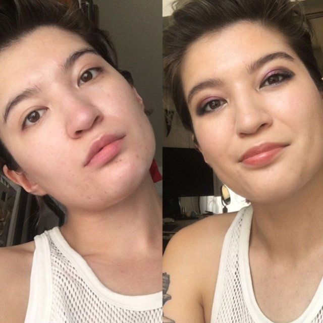 I'm not wearing makeup in the first photo. In the second, I have on makeup and had been using the rice cleanser and the Maycoop Raw Sauce Mini Duo for a couple weeks. I am a skin care nerd, but I also have a chronic illness that interacts with my hormones, so my acne scarring on my chin is pretty much constant.