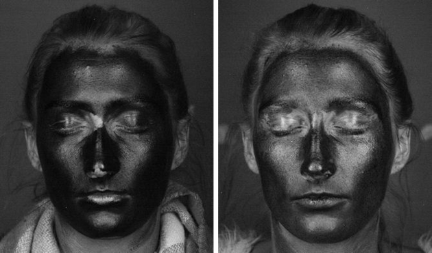 The images show the level of sun protection on the same woman’s face under a UV camera, when wearing suncream (left) and when wearing SPF containing moistursier (right).