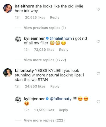 Kylie Jenner confirmed via an Instagram post that she stopped using lip filler.