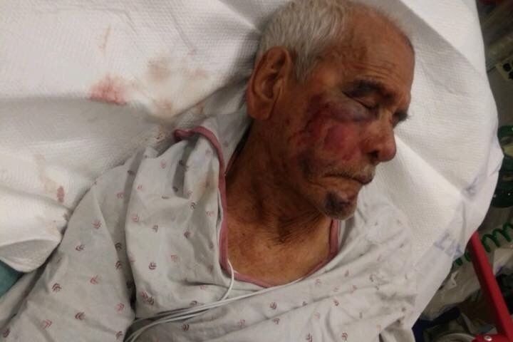 Rodolfo Rodriguez, who will turn 92 in September, recovers in the hospital after the alleged July 4 attack.