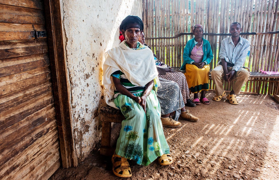 Wosani Wolanchu at a clinic in the village of Waro in southern Ethiopia. Wosani suffers from advanced stage podoconiosis.