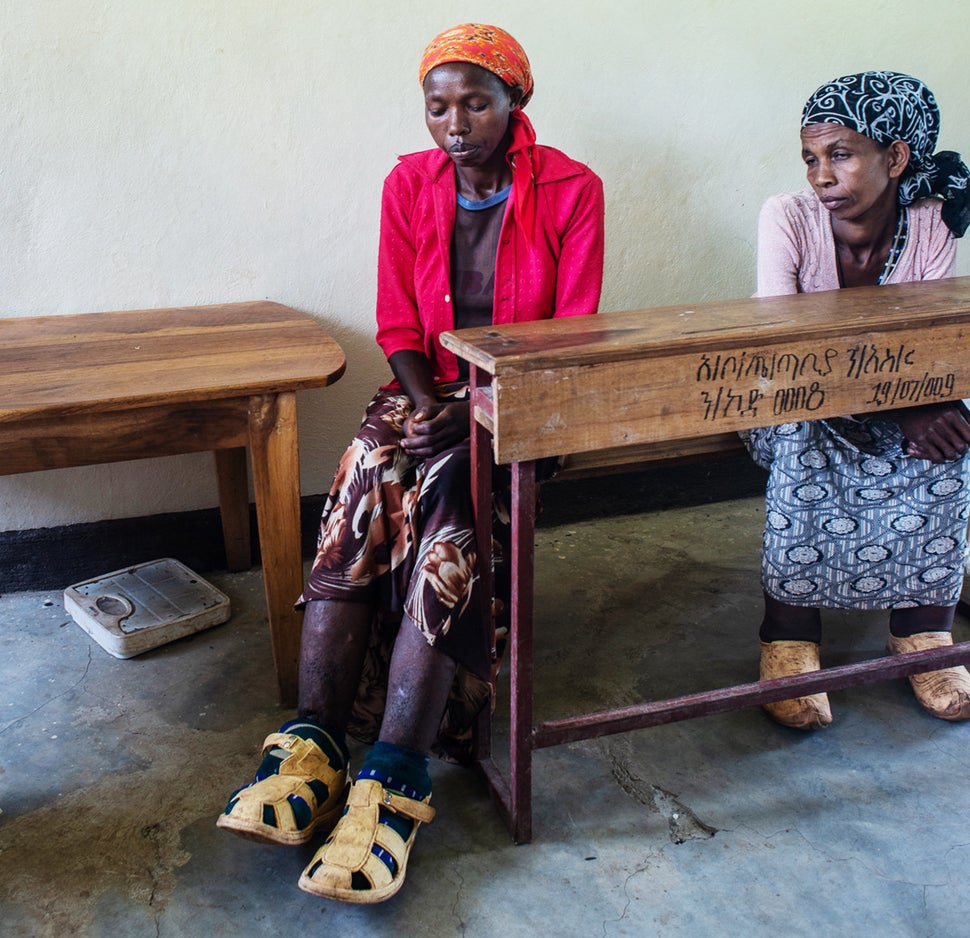 Meselch Dea, a 25-year-old woman who has suffered from severe podoconiosis since her mid-teens, at a clinic in Dawro district