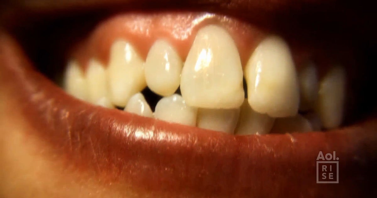 How to Drink Tea Without Staining Your Teeth HuffPost Videos