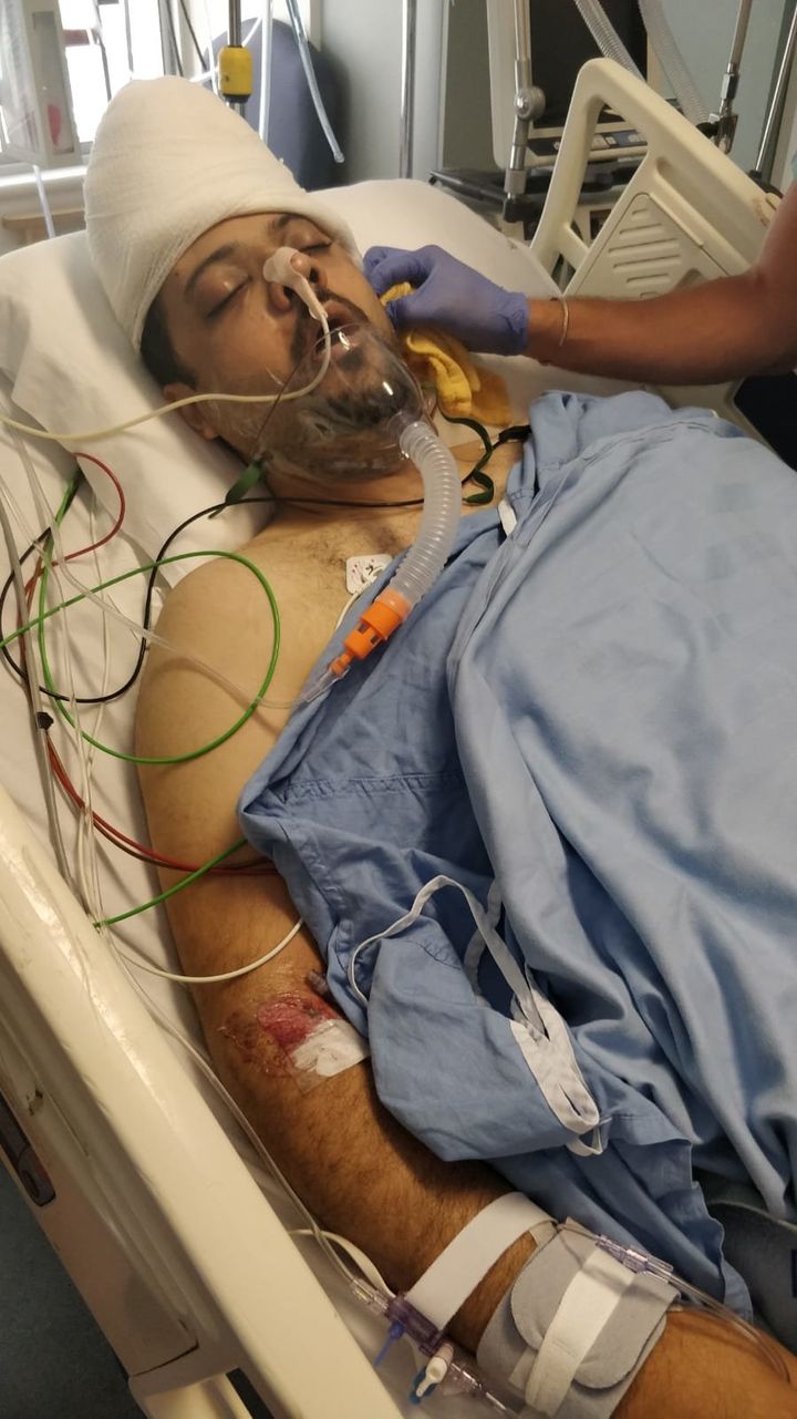 Muhammed Abu Marzouk was assaulted in Mississauga, Canada, in what police are investigating as a hate crime. He is being treated for multiple fractures to his face and a brain hemorrhage.