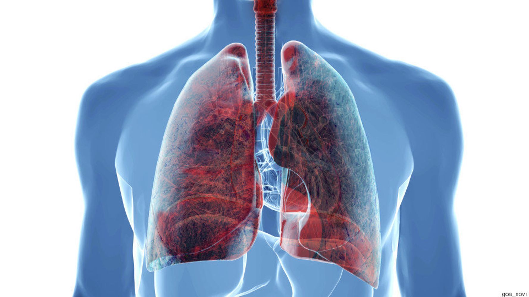 Cuba Leading The Way In Lung Cancer Vaccines HuffPost