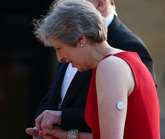 Theresa May wears a diabetes monitoring sensor while visiting Blenheim Palace with US President Donald Trump.