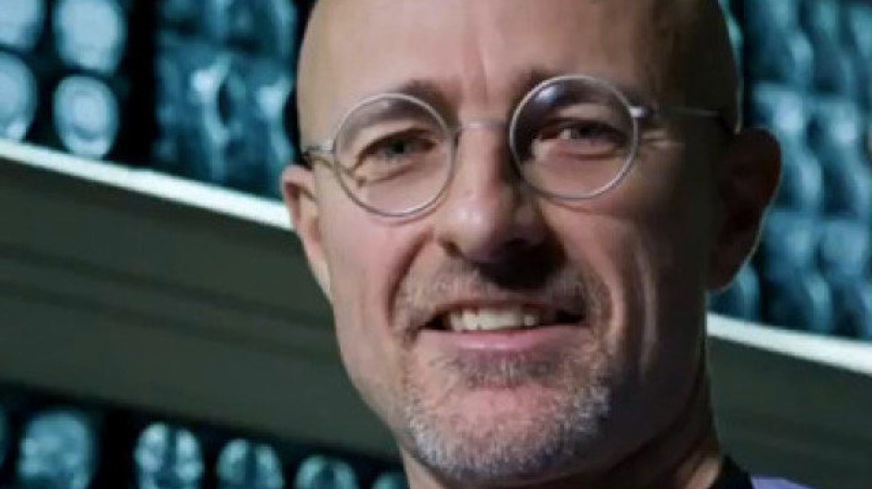 Human Head Transplants Now Possible Huffpost Videos