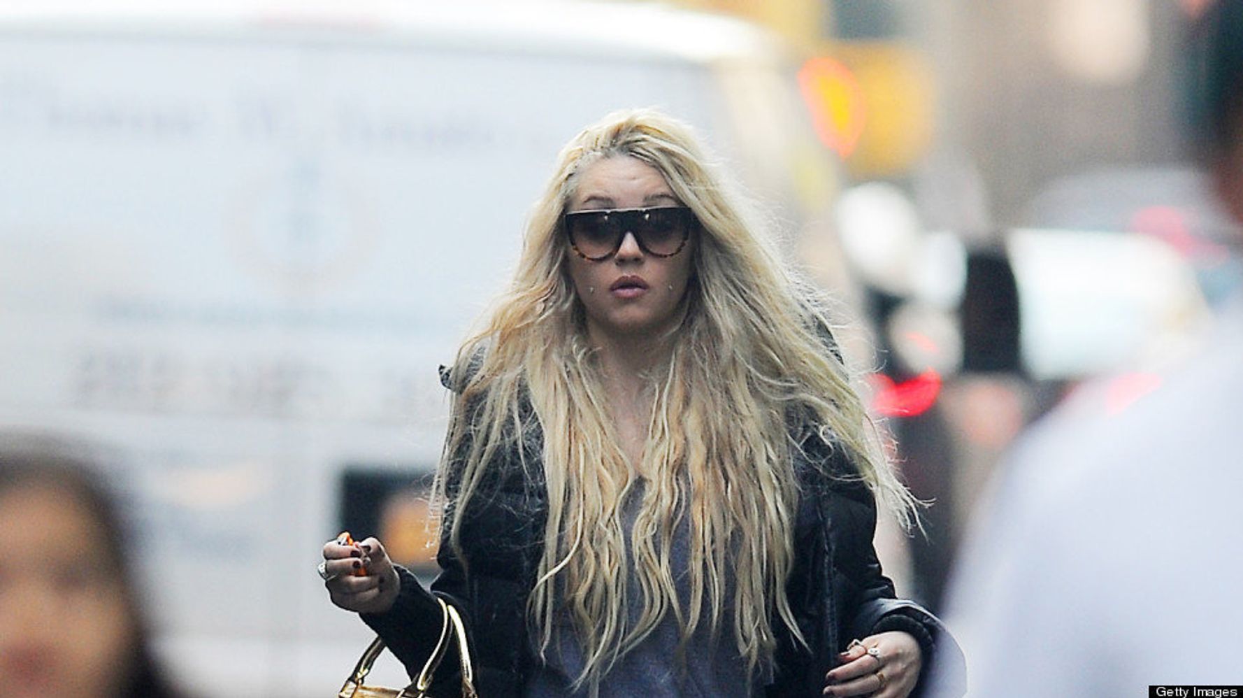 Amanda Bynes Reveals Plastic Surgery