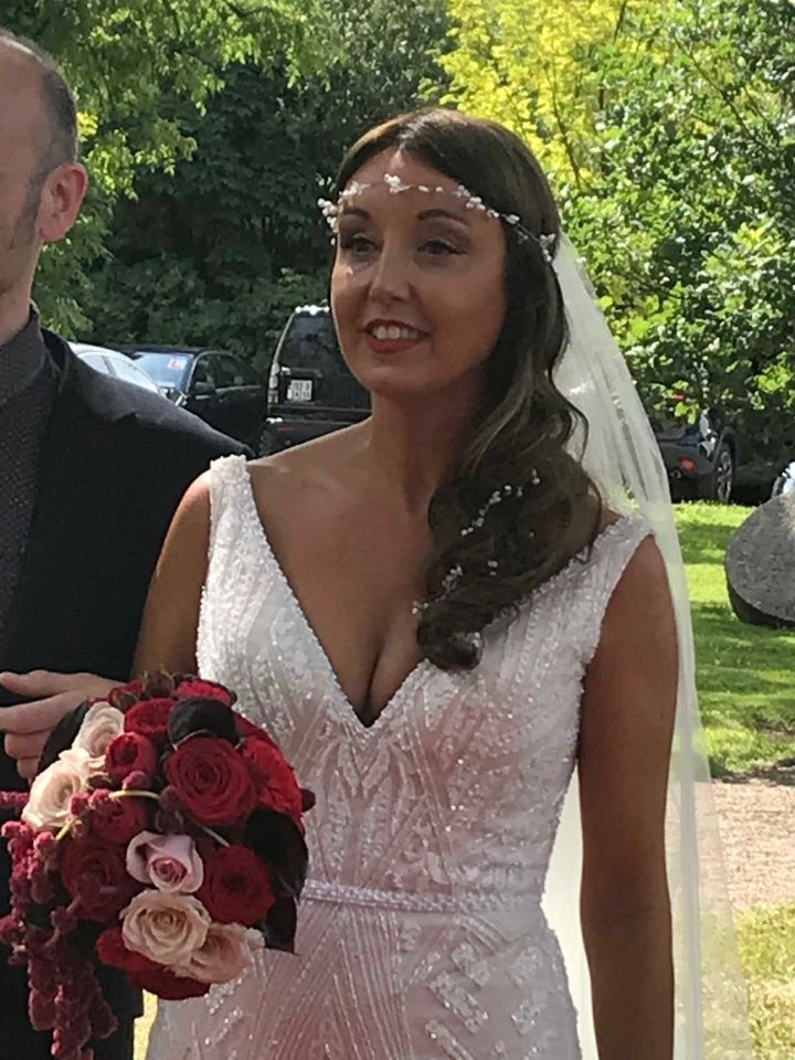 Newlywed Zoe Holohan is being treated in hospital for burns to her head and hands.