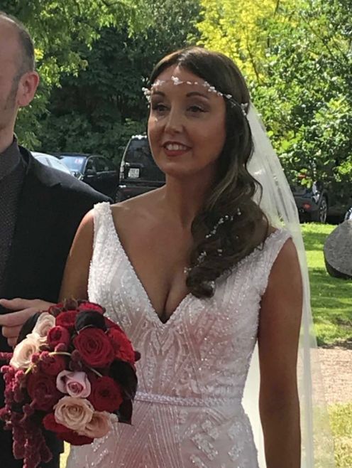 Newlywed Zoe Holohan is being treated in hospital for burns to her head and hands