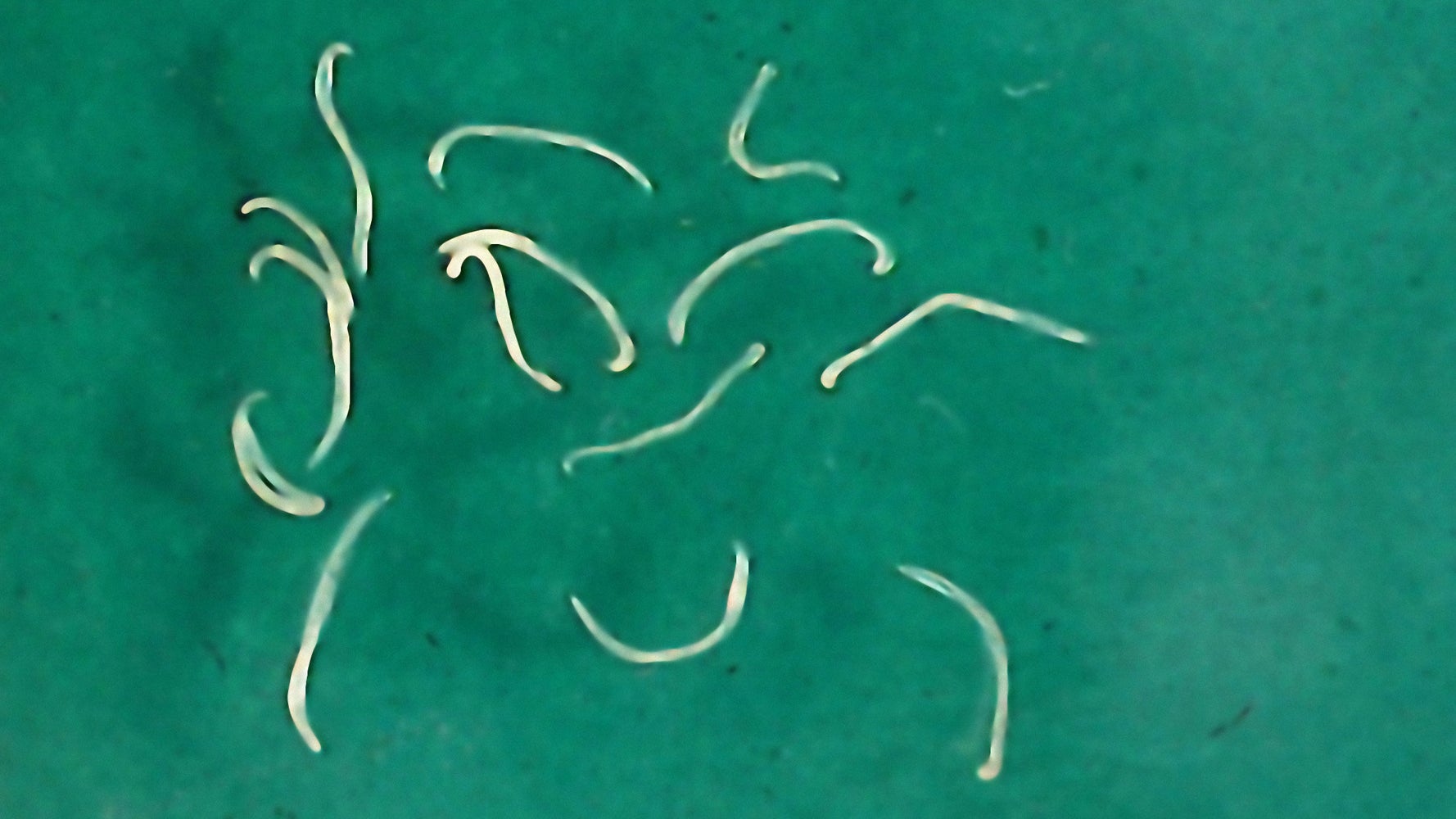 Teen Gets Gruesome Hookworm Infection After Friends Bury Him In The ...