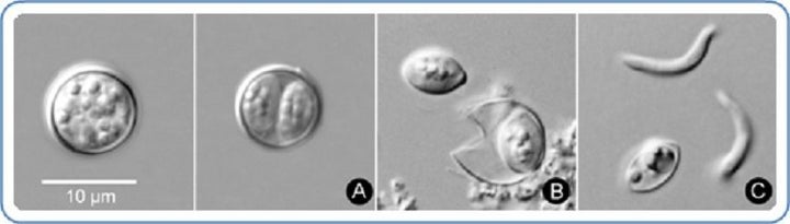 Cyclospora cayetanensis oocysts, which are shed by infected feces, are seen. The parasite becomes infective to others at the