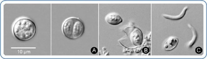 Cyclospora cayetanensis oocysts, which are shed by infected feces, are seen. The parasite becomes infective to others at the last stage (C) pictured.